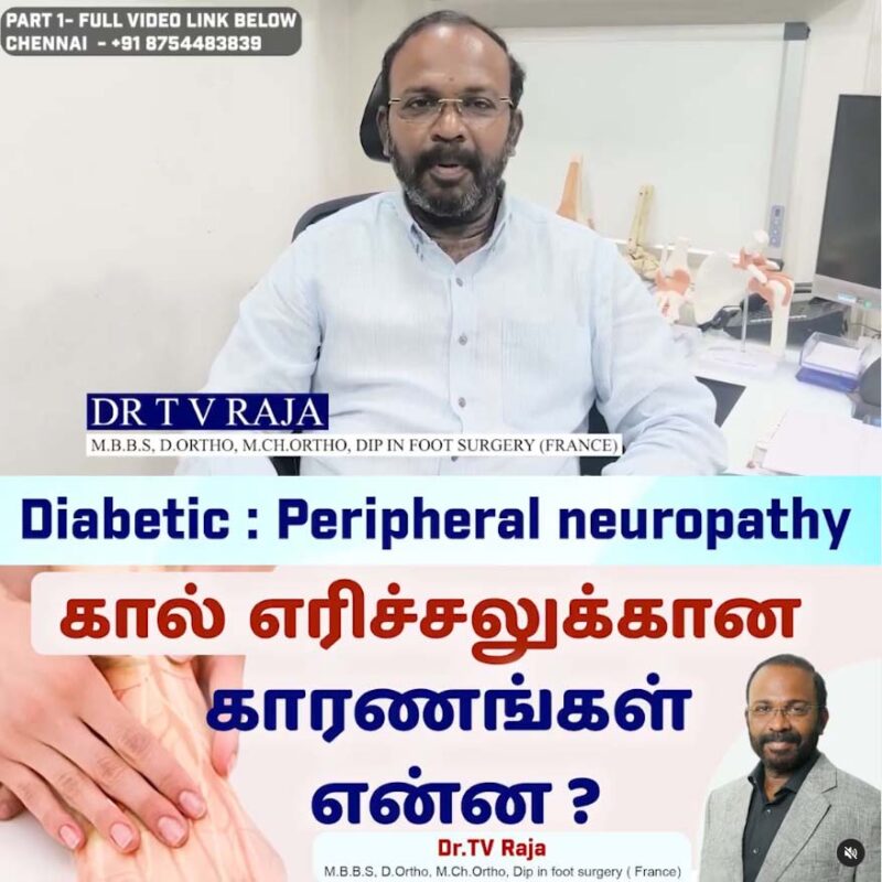 Diabetic Neuropathy in Tamil | கால் எரிச்சலுக்கான காரணங்கள் என்ன ?